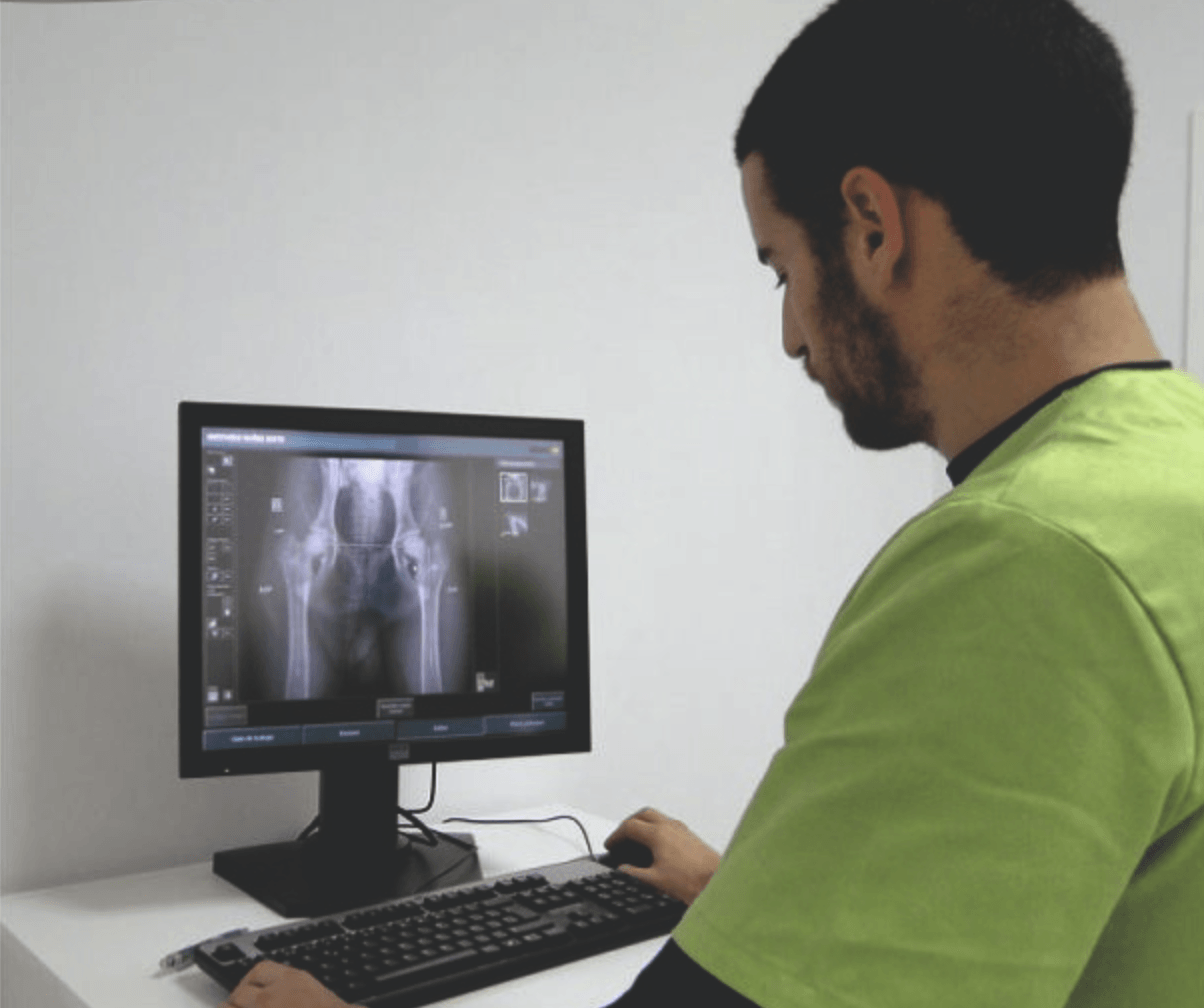 radiografía oficial de displasia de cadera